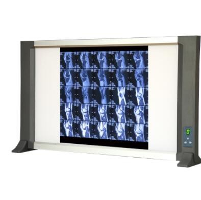 2联智能X射线胶片观片灯铝合金观片灯医用双联X射线胶片观灯片