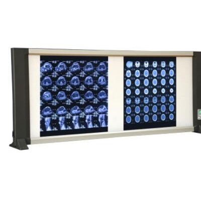 厂家批发双联LED胶片观片灯X射线医用阅灯片CT片可调光高亮度骨科